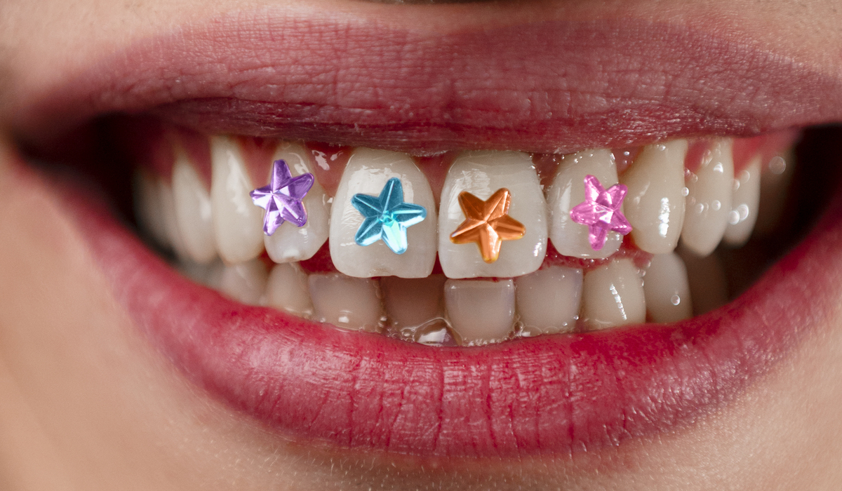 Tooth Gem Viral: Ketahanan dan Perawatan Aksesori Gigi Gen Z